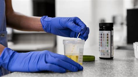 Urine drug tests: Uses, procedure, detection times, and results